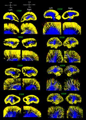 Convergence of Cortical, Thalamocortical, and Callosal Pathways during Human Fetal Development Revealed by Diffusion MRI Tractography